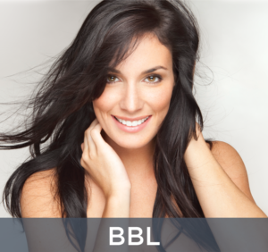 BBL photofacial laser services