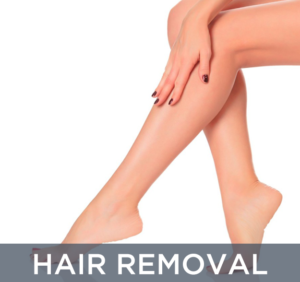laser hair removal laser services