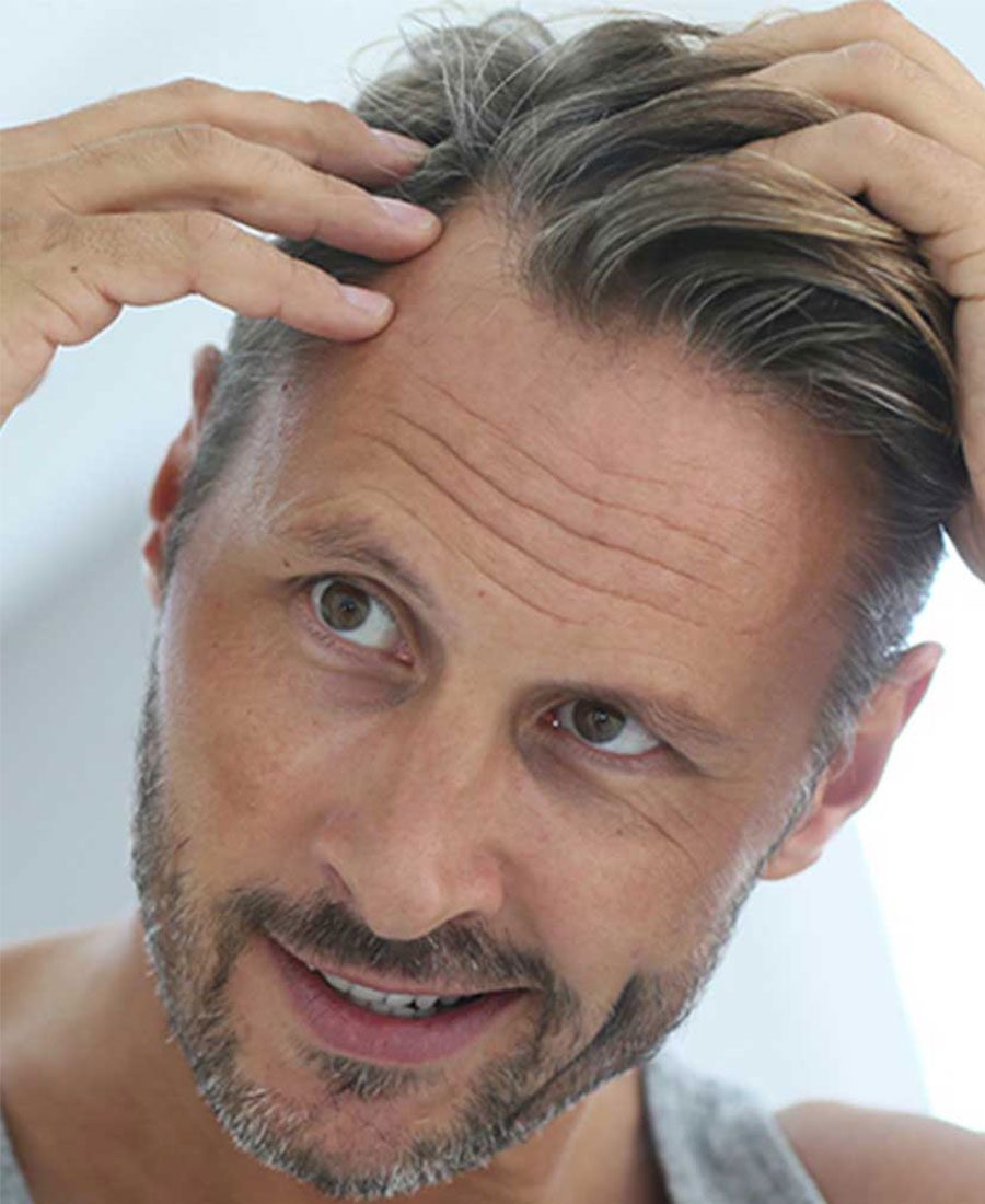 PRP For Hair Regrowth